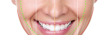 Aesthetic And Cosmetic Dentistry - Smile Tijuana Dentist